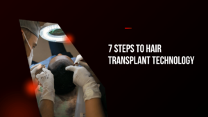 7 steps to hair transplant technology