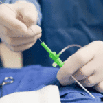 What Does a Cath Lab Tech Do?